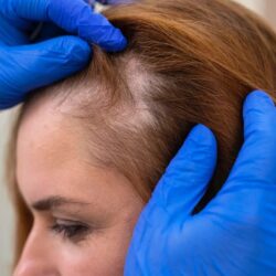 hair_image_200kb