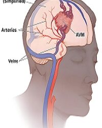 sidharthvascular.com