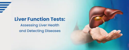 liver-function-tests-assessing-liver-health-detecting-diseases liver-function-tests-assessing-liver-health-detecting-diseases