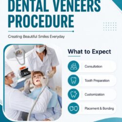 Dental Veneers Clinic
