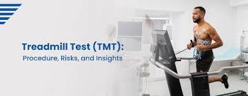 treadmill test treadmill test