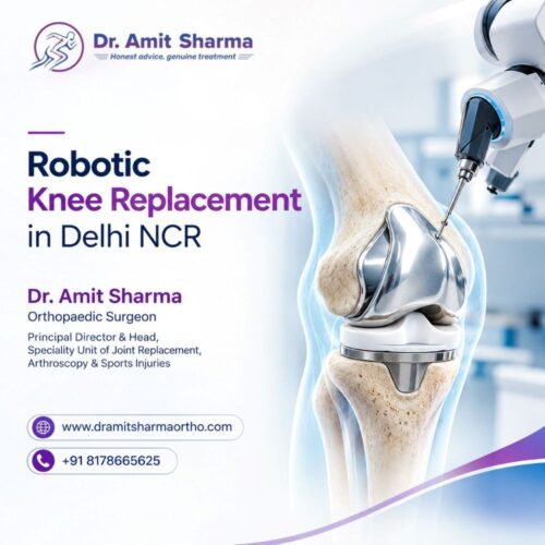 Robotic Knee Replacement in Delhi-NCR Robotic Knee Replacement in Delhi-NCR