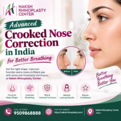 Advanced Crooked Nose Correction in India for Better Breathing