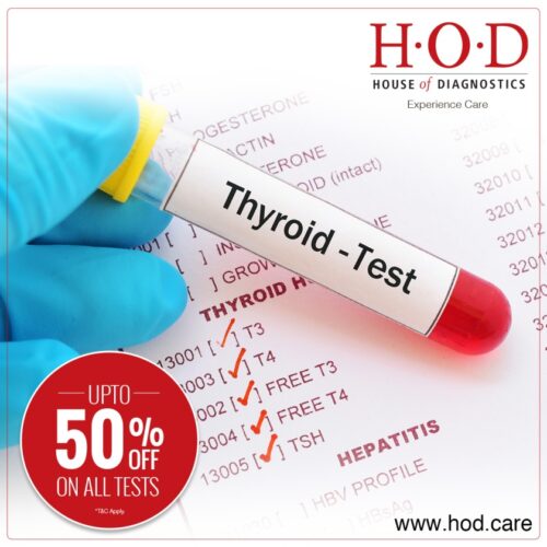Thyroid-Function-Test-(TFT)- Thyroid-Function-Test-(TFT)-